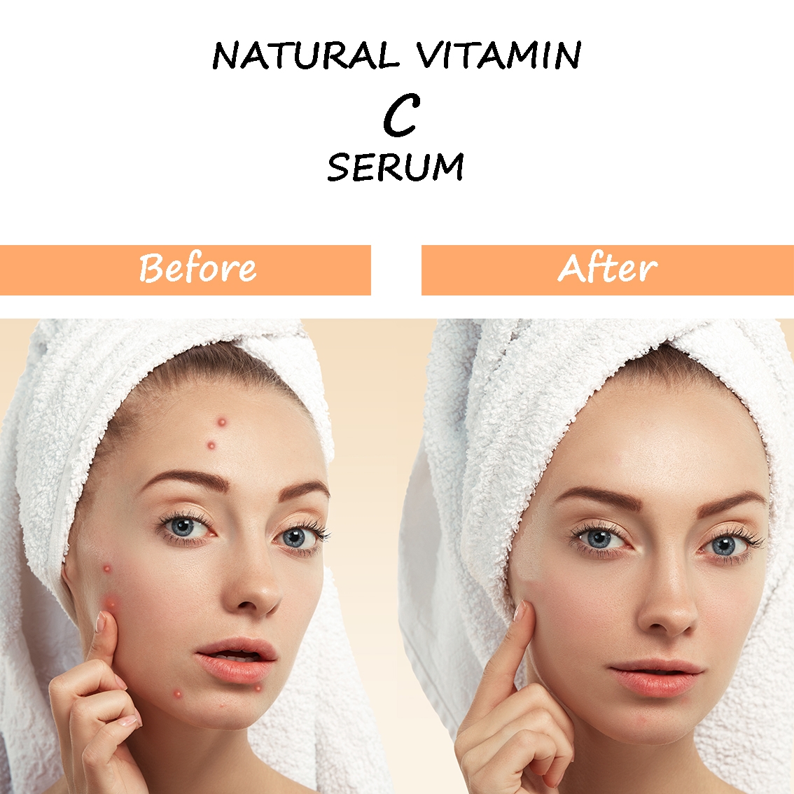 SWOSH Vitamin C Serum for face Whitening, Pigmentation, Glowing, Oily Skin, Acne Scars, Brightening, Fairness, Anti-Aging Skin Repair, Dark Circle, Fine Line & Sun Damage Corrector 30 ML
